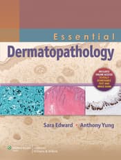 Essential Dermatopathology