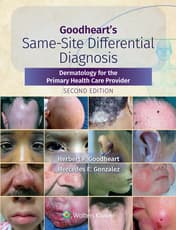 Goodheart's Same-Site Differential Diagnosis