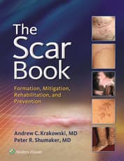 The Scar Book