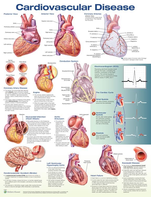 Cardiovascular Disease Anatomical Chart