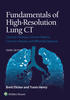Fundamentals of High-Resolution Lung CT