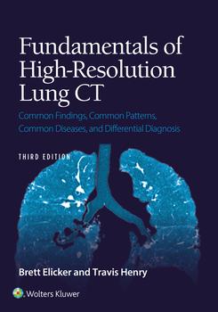 Fundamentals of High-Resolution Lung CT