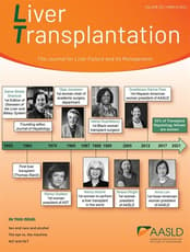 Liver Transplantation Online