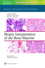 Biopsy Interpretation of the Bone Marrow: Print + eBook with Multimedia