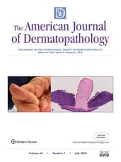 American Journal of Dermatopathology Online