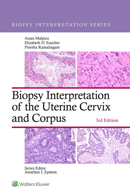 Biopsy Interpretation of the Uterine Cervix and Corpus: eBook with Multimedia