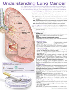 Understanding Lung Cancer Anatomical Chart