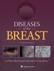 Diseases of the Breast 5e