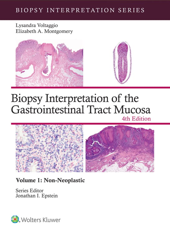 Biopsy Interpretation of the Gastrointestinal Tract Mucosa Volume 1