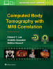 Computed Body Tomography with MRI Correlation