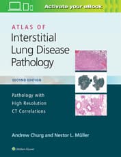 Atlas of Interstitial Lung Disease Pathology