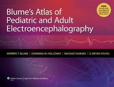 VitalSource E-Book for Blume's Atlas of Pediatric and Adult Electroencephalography