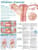 Understanding Ovarian Cancer Anatomical Chart