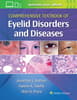 Comprehensive Textbook of Eyelid Disorders and Diseases