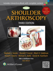 Shoulder Arthroscopy