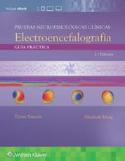 Pruebas neurofisiológicas clínicas. Electroencefalografía