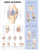 Knee Injuries Anatomical Chart