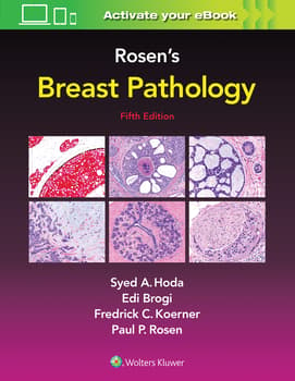 Rosen's Breast Pathology