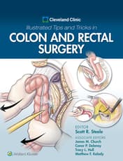 Cleveland Clinic Illustrated Tips and Tricks in Colon and Rectal Surgery