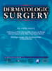 Dermatologic Surgery Online