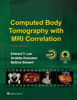 Computed Body Tomography with MRI Correlation