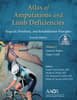 Atlas of Amputations & Limb Deficiencies, 4th edition: Print + Ebook