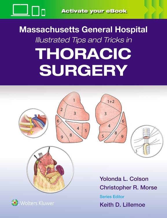 Massachusetts General Hospital Illustrated Tips and Tricks in Thoracic Surgery: Print + eBook with Multimedia