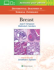 Differential Diagnoses in Surgical Pathology: Breast