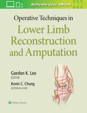 Operative Techniques in Lower Limb  Reconstruction and Amputation