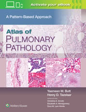 Atlas of Pulmonary Pathology