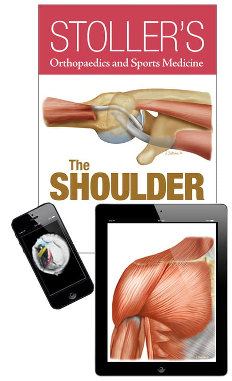 Stoller's Orthopaedics and Sports Medicine: The Shoulder Package