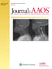 JAAOS®,  - Journal of the American Academy of Orthopaedic Surgeons