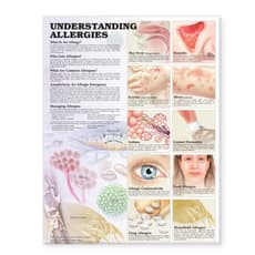 Understanding Allergies Anatomical Chart