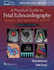 A Practical Guide to Fetal Echocardiography