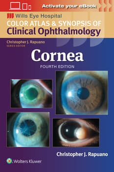 Cornea: Print + eBook with Multimedia