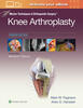 Master Techniques in Orthopedic Surgery: Knee Arthroplasty