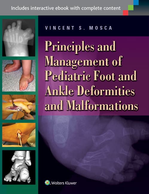 Foot and Deformities and Malformations in Children: A Principles-Based, Practical Guide to Assessment and Management