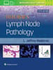 Ioachim's Lymph Node Pathology