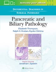 Differential Diagnoses in Surgical Pathology: Pancreatic and Biliary Pathology