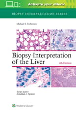 Biopsy Interpretation of the Liver