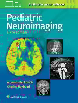 Pediatric Neuroimaging