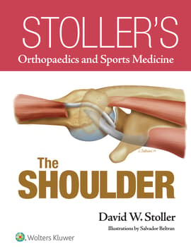 Stoller’s Orthopaedics and Sports Medicine: The Shoulder