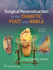 Surgical Reconstruction of the Diabetic Foot and Ankle