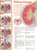 Understanding Kidney Cancer Anatomical Chart