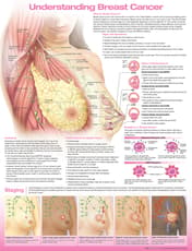 Understanding Breast Cancer Anatomical Chart