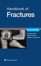 Handbook of Fractures: eBook with Multimedia