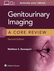 Genitourinary Imaging: A Core Review