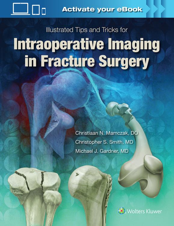 Illustrated Tips and Tricks for Intraoperative Imaging