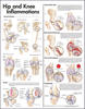 Hip and Knee Inflammations Anatomical Chart