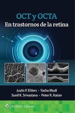 OCT y OCTA en trastornos de la retina